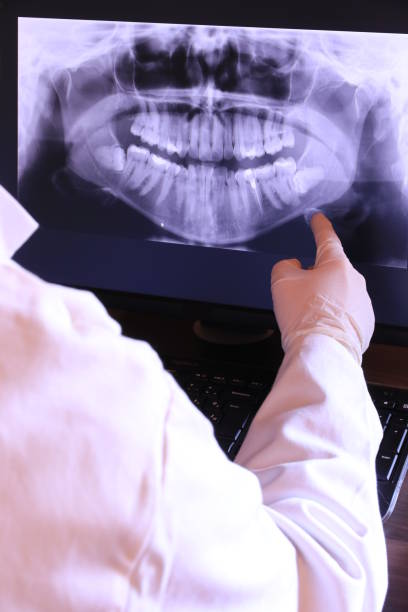Best Emergency Dental Surgery in Hudson Bend, TX