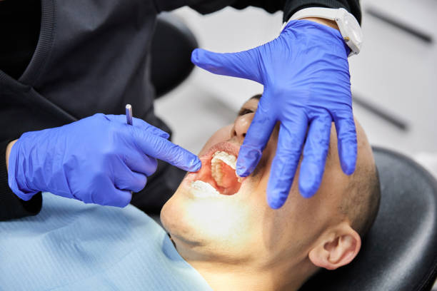 Best Emergency Tooth Extraction in Hudson Bend, TX