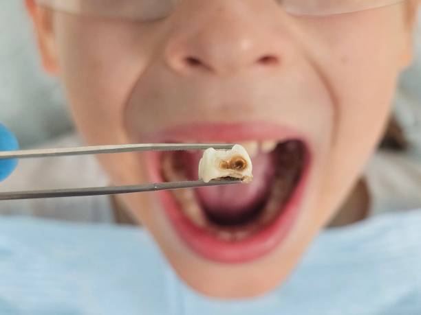 Best Emergency Dental Care for Trauma or Injury in Hudson Bend, TX